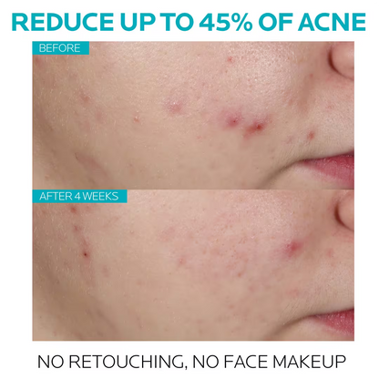 La Roche-Posay Suero facial Effaclar con ácido salicílico